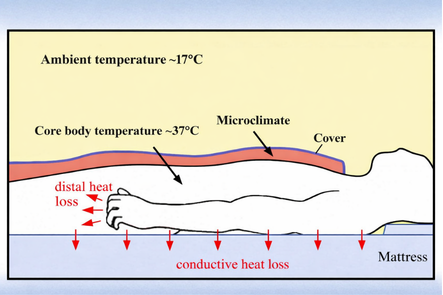 Schematische Darstellung des Bett-Mikroklimas: Raumtemperatur ~17 °C, Körperkern ~37 °C, Mikroklima unter der Decke, konduktiver Wärmeverlust durch die Matratze, distaler Wärmeverlust über die Extremitäten.
